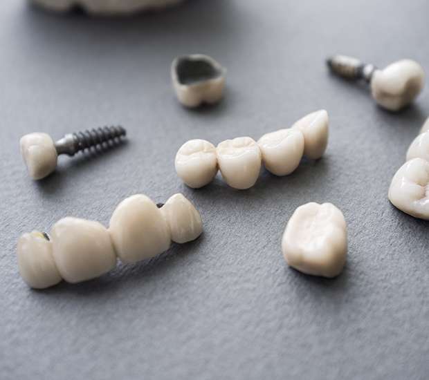 Glendale The Difference Between Dental Implants and Mini Dental Implants