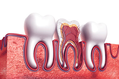 A Root Canal Dentist In Glendale: Explaining The Basics Of A Root Canal