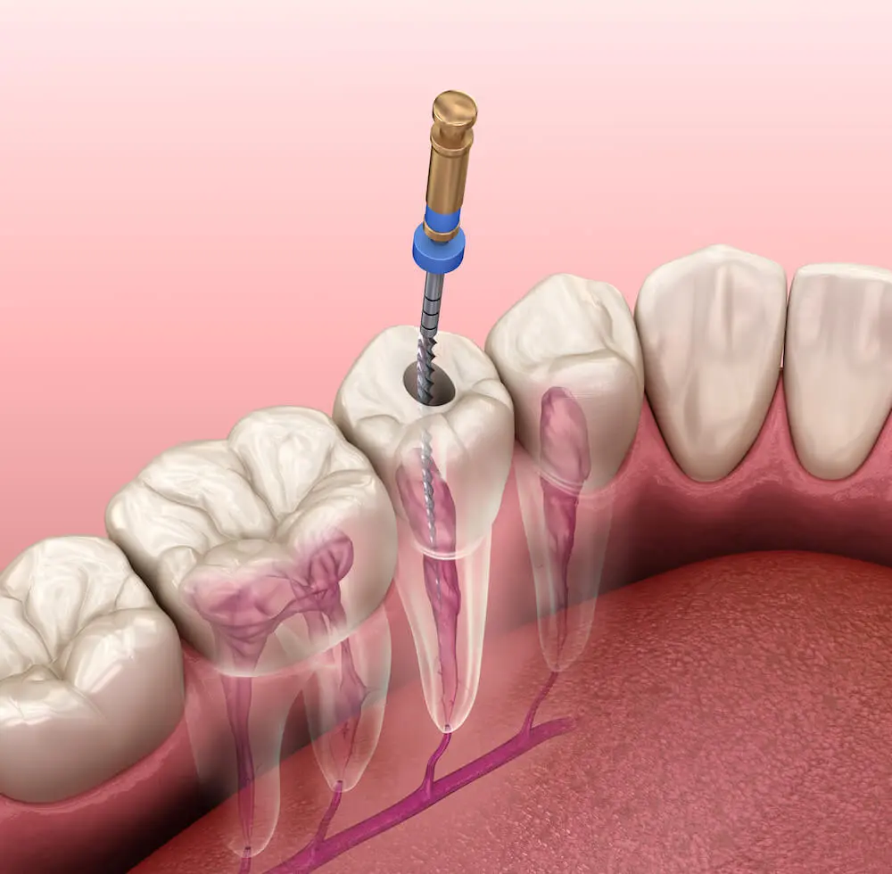 Why Six-Month Dental Checkups Matter More Than You Think