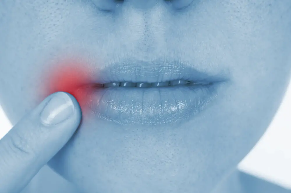 How to Prevent Cavities as an Adult
