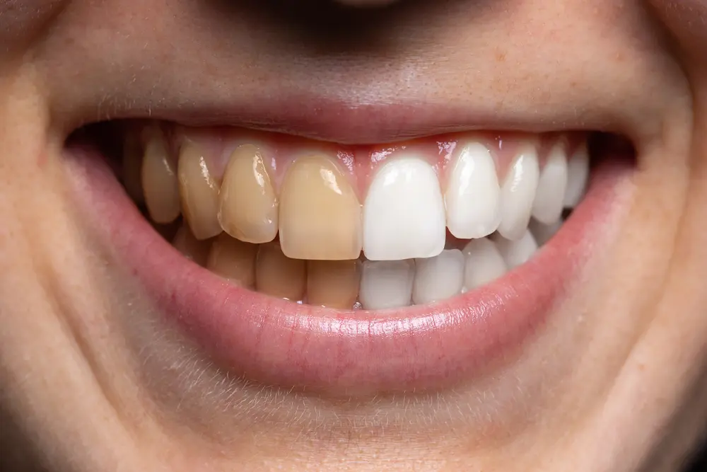 The Link Between Oral Health and Heart Health