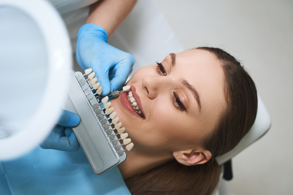 What Are Dental Veneers? What You Should Know