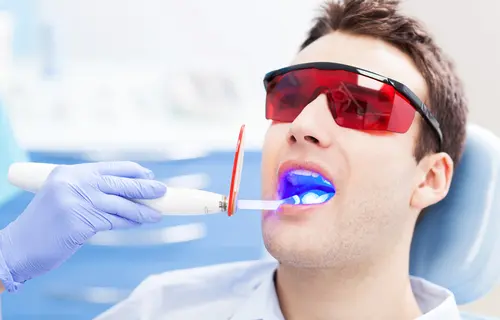 Is Teeth Whitening Safe for Your Enamel?