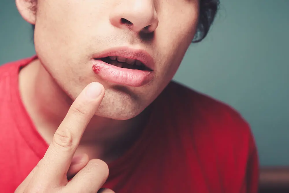 How to Care for a Dental Bridge