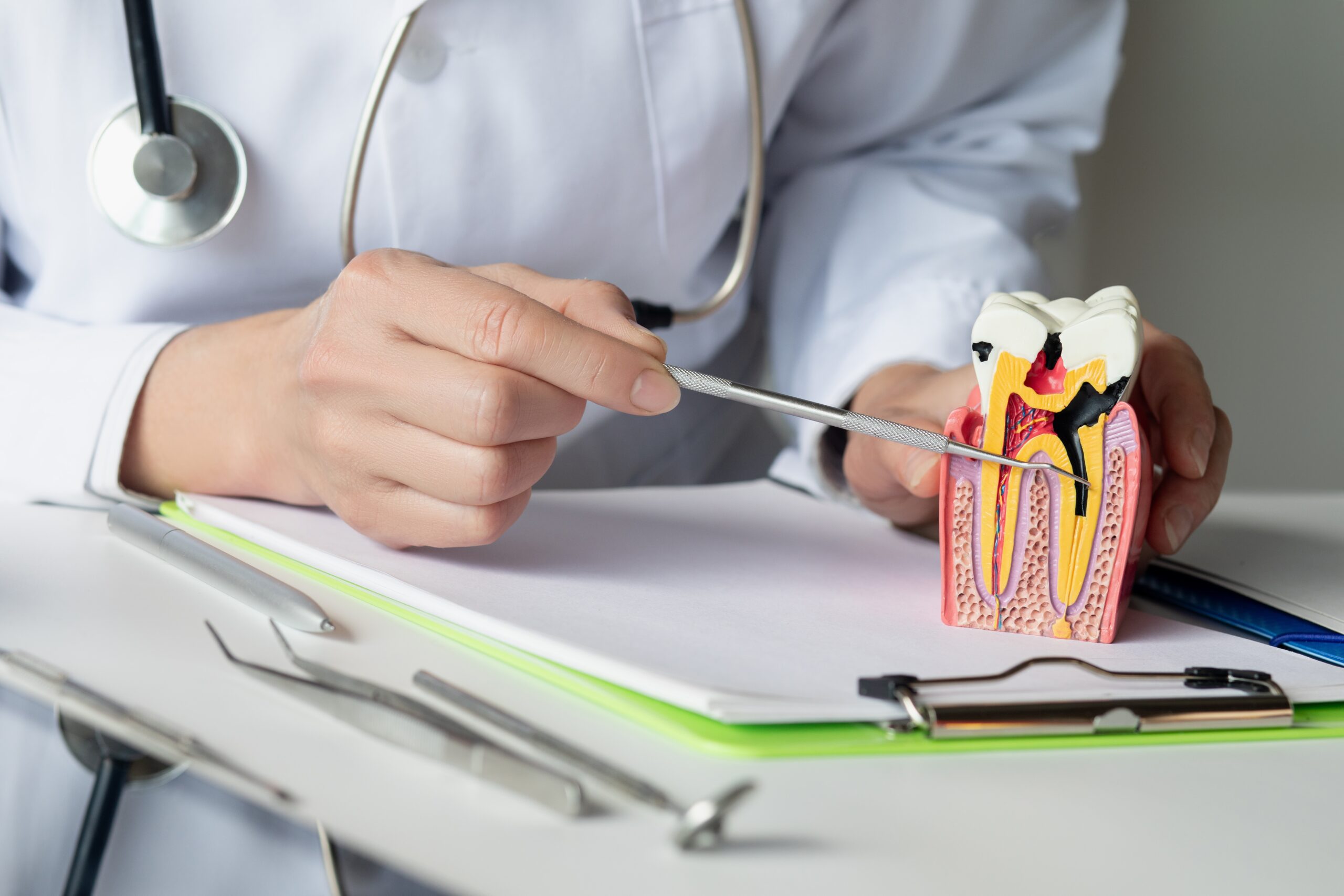 How To Avoid A Root Canal Tips For Healthier Teeth