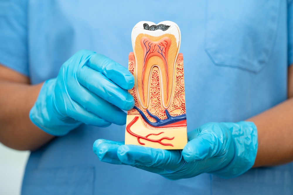 Tips For Root Canal Recovery