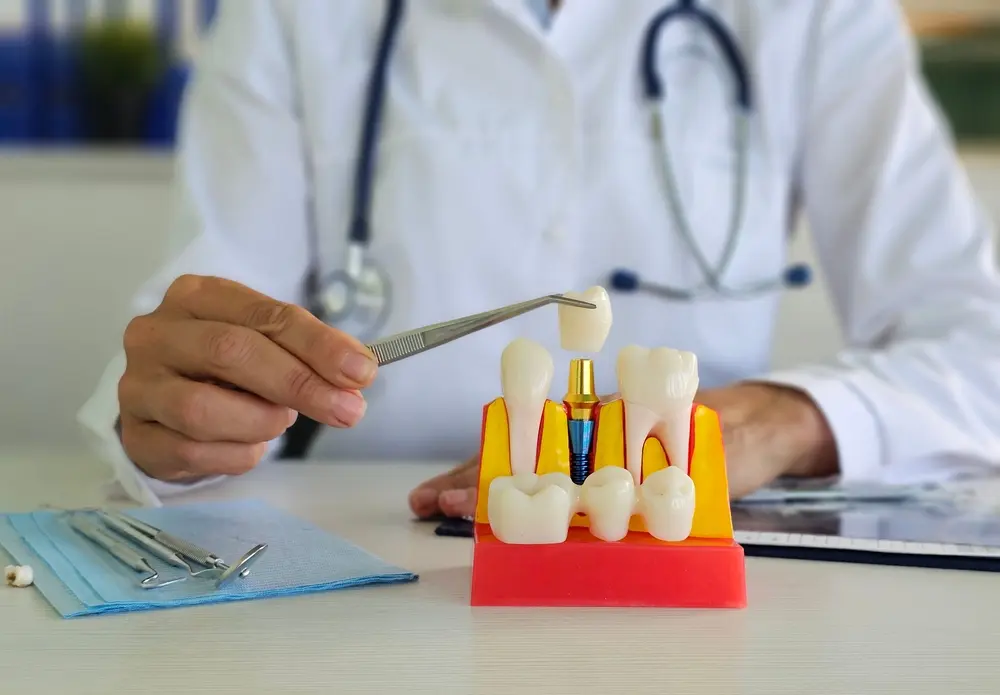 Teeth Grinding (Bruxism): Signs and Night-Guard Solutions