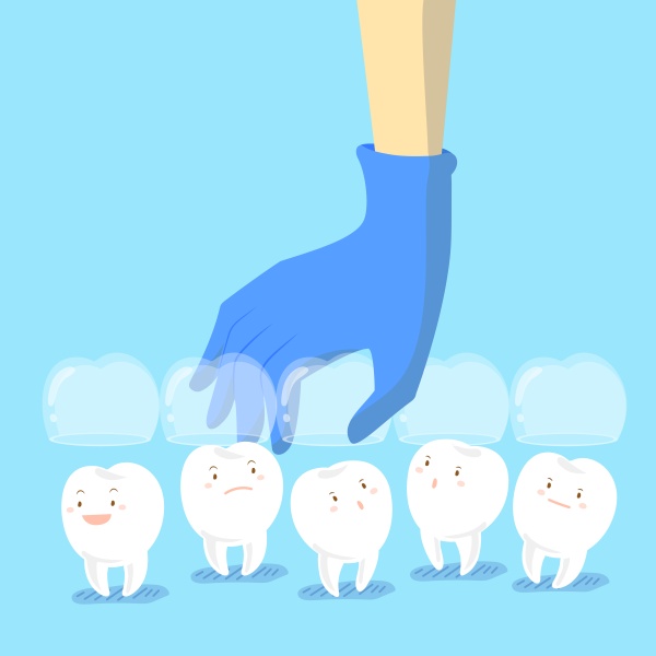What Are Dental Appliances?